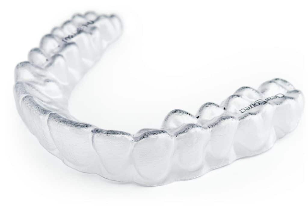Clear Tray System Orthodontics Are All the Rage
