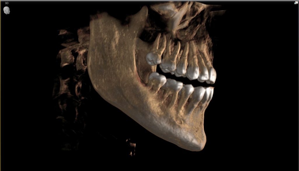 Benefits of the Cone Beam CT Scan at Origin Dental Wellness